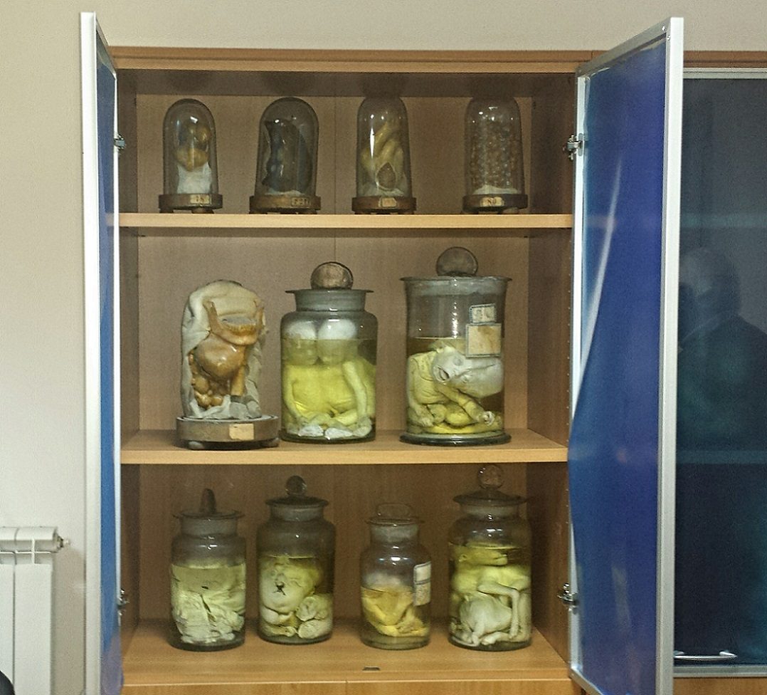 Antonio Cardarelli's Hospital anatomical preparations.jpg
